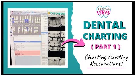DENTAL CHARTING FOR DENTAL ASSISTANTS // PART 1 // Charting Existing