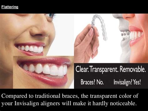 3d computer stimulation:this system works. Invisalign advantages and disadvantages