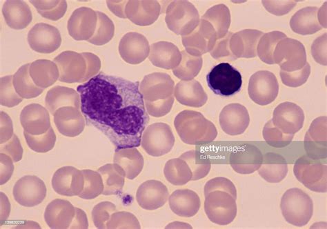 Monocyte Lymphocyte White Blood Cells The Monocyte Is The Largest Wbc
