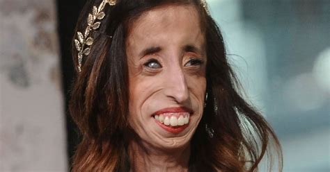 Woman Branded World S Ugliest Reveals How She Fought Back Against