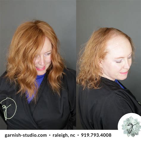 Custom Crown 👑 👑 Hair Studio Hairstyles For Thin Hair Premium Hair