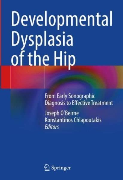 Developmental Dysplasia Of The Hip Book 2022
