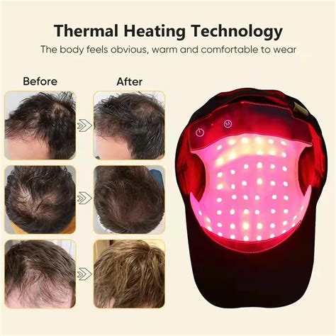 Sungrow Nm Home Use Helmet Red Blue Hat Full Scalp Led Treatment