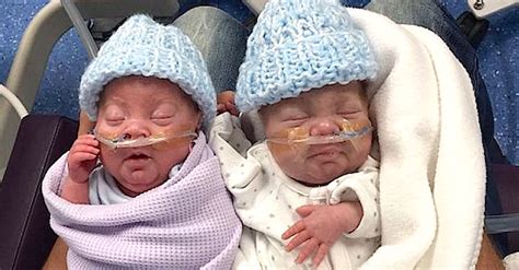 Premature Twin Brothers From The Uk Defy All Medical Odds