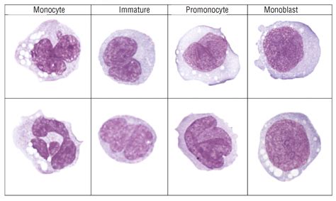 Morphological Evaluation Of Monocytes And Their Precursors Haematologica