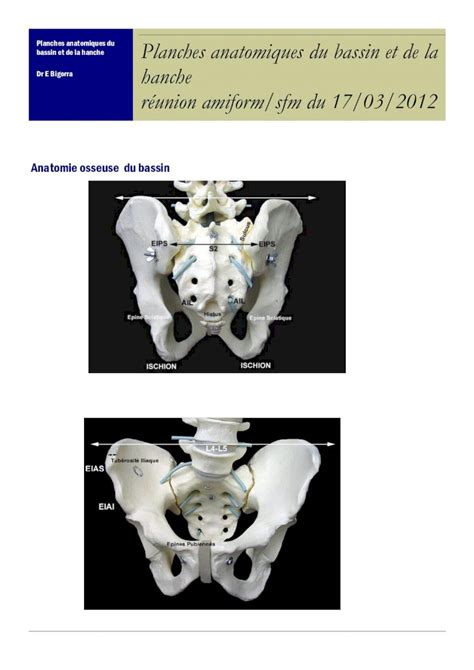 Planche Anatomique Bassin Et Hanche Anatomie Et Pathologie B My Xxx