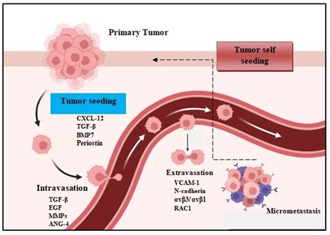 Metastatic Dissemination In Lung Carcinogenesis Encyclopedia Mdpi