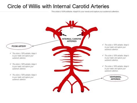 Circle Of Willis With Internal Carotid Arteries Presentation Graphics