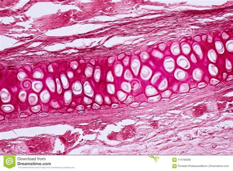 This simply involves placing a section of the bone on the microscope stage and viewing the. Cross Section Human Cartilage Bone Under Microscope View ...
