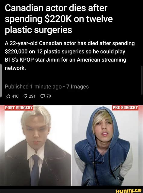 Canadian Actor Dies After Spending 220k On Twelve Plastic Surgeries 22 Year Old Canadian Actor