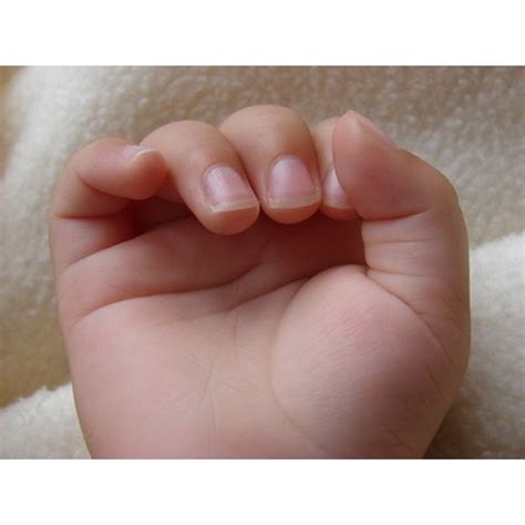 We did not find results for: What Causes Horizontal Ridges in Fingernails? | Healthfully