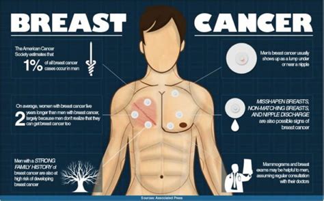 Breast Cancer Can And Does Happen To Men