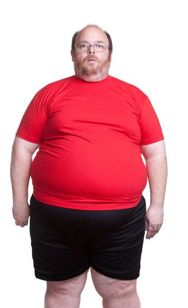 Obesity Catch Body Last Causes What Is Obesity