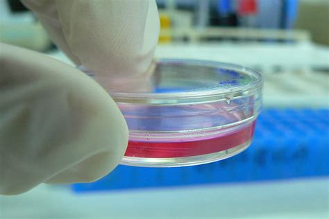 Cell Culture | Flickr - Photo Sharing!