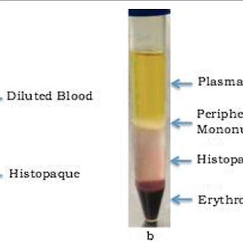 Blood Sample Collected For Isolation Of Lymphocytes B Different Layers