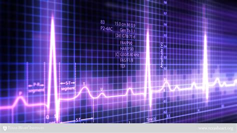 Electrocardiogram Texas Heart Institute