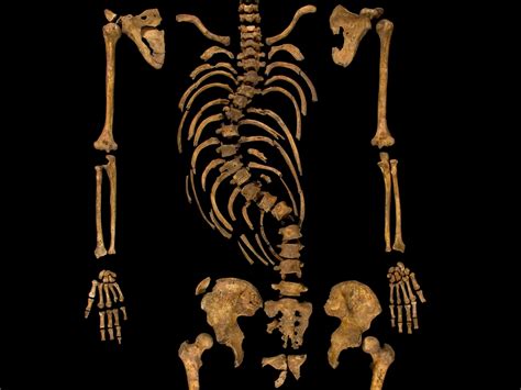 No Hunch Here Richard Iii Suffered From Scoliosis Instead Ncpr News