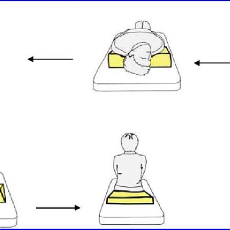 Right Sided Epley Maneuver