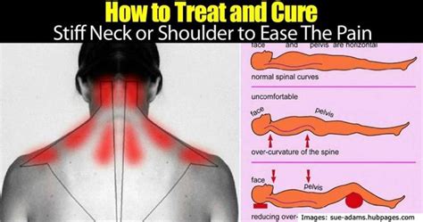 The Most Common Cause Of Stiff Neck Andor Neck And Shoulder Pain Is