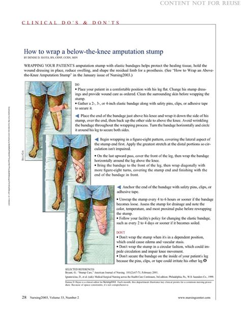 How To Wrap A Below The Knee Amputation Stump Nursing2021 Below The