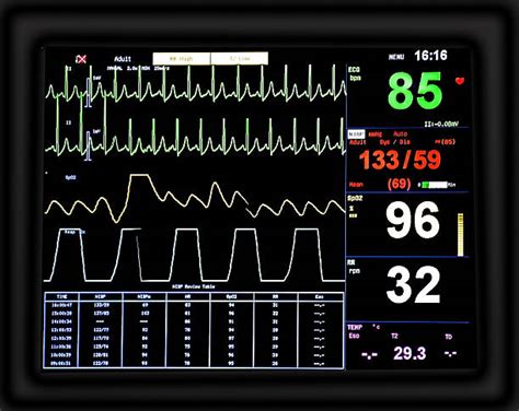 Heart Monitor Screen Stock Photos Pictures And Royalty Free Images Istock