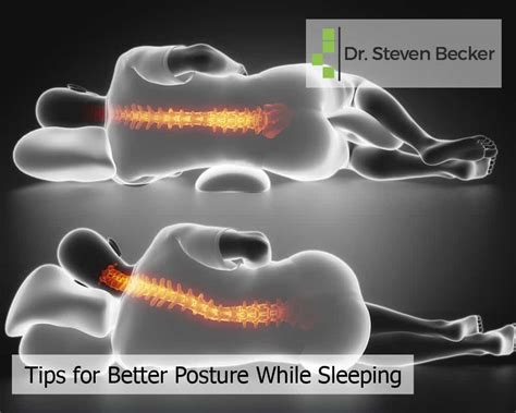 Tips For Better Posture While Sleeping Chiropractor Los Angeles Ca