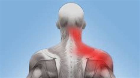 Shoulder Cervical Pain Vlrengbr