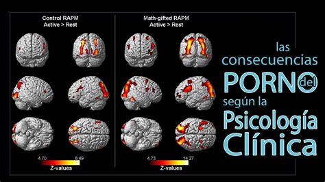 Las Graves Consecuencias De La Pornografía Según La PsicologÍa ClÍnica Youtube