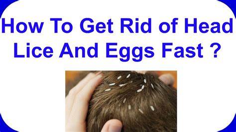 How To Get Rid Of Head Lice And Eggs Fast Get Rid Head Lice Home