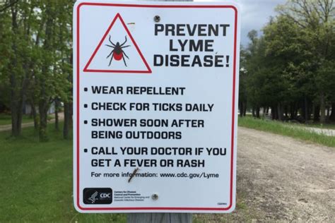 Kewaunee County Health Department Raises Lyme Disease