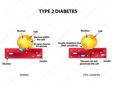 According to the american diabetes association, about 34 million people in the united states — both adults and children — are living with diabetes, and an additional 1.5 million people are diagnosed every year. Pictures : diabetes type 2 | The absorption of glucose by ...