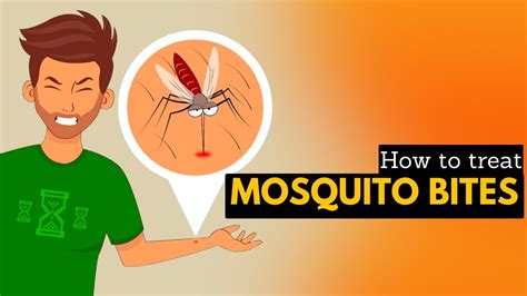 How To Treat Mosquito Bites Youtube