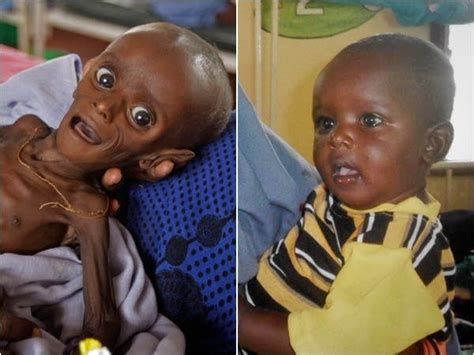 Somalia Famine Baby Back From Brink Of Death Mpr News