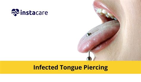 Infected Tongue Piercing Causes Symptoms Prevention And Treatment