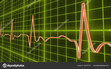 Ecg Line Graph Heart Beating In Normal Sinus Rhythm Healthcare And