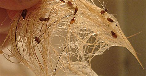 If you've found strange white, brown or black flecks on your pet's body or on their bedding, this might be another clear sign of a flea infestation. How to know if you have fleas in your house | eHow UK