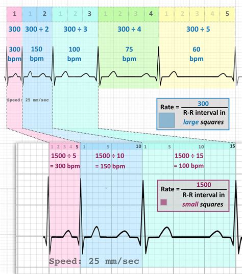 Ekg Heart Rate Table Images And Photos Finder