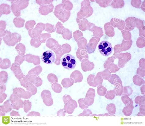 Blood Smear Anemia Patient Show Nrbc Medical Science Royalty Free Stock