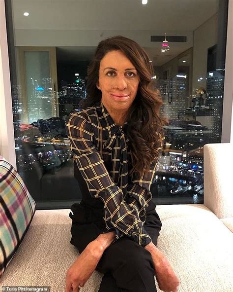 Turia Pitt Shares Inspirational Message For Those Struggling In Isolation Daily Mail Online