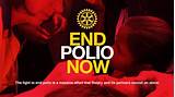 Pictures of Polio Rotary