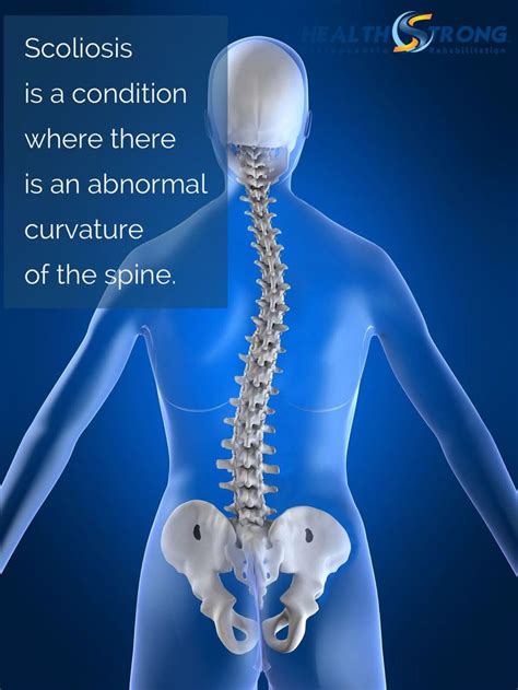 Pin On Benefits Of Chiropractic