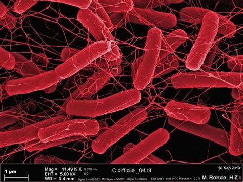 Clostridium Difficile Der Heimtückische Keim Innovations Report