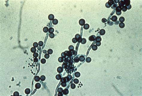 M241 5 Chlamydospores Of Candida Albicans Goodman Flickr