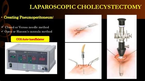 Laparoscopic Cholecystectomy Operative Surgery