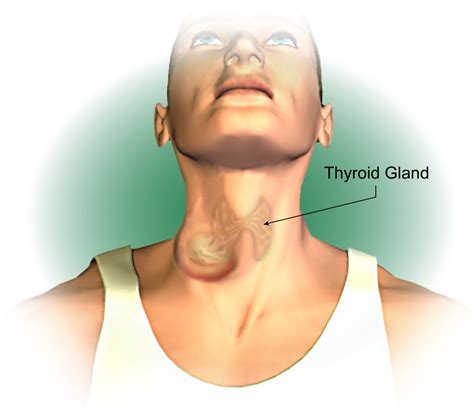 Thyroid Lump In Neck Pictures To Pin On Pinterest Thepinsta