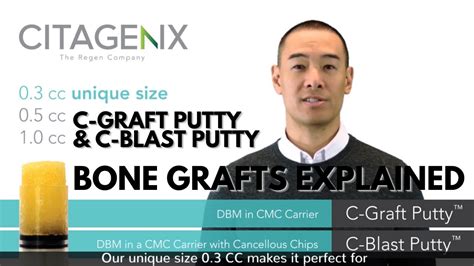 Bone Grafts For Dental Implants C Graft Putty And C Blast Putty