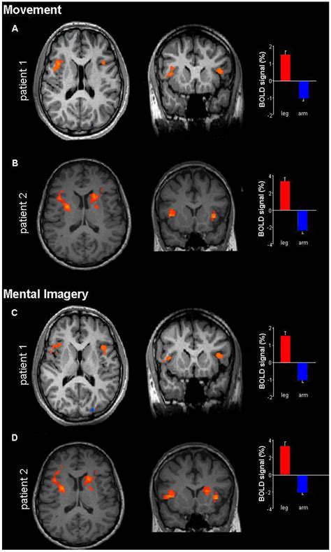 Brain Sciences Free Full Text Disturbed Mental Imagery Of Affected