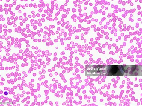 Red Blood Cells 40x Light Micrograph High Res Stock Photo Getty Images