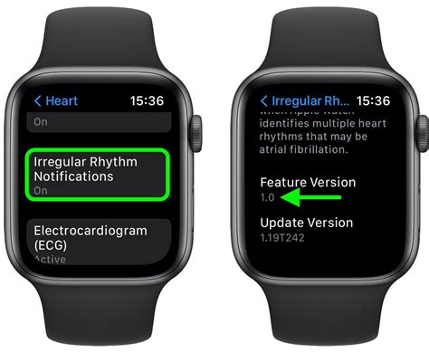 How To Check Which Version Of The Irregular Rhythm Notification Feature