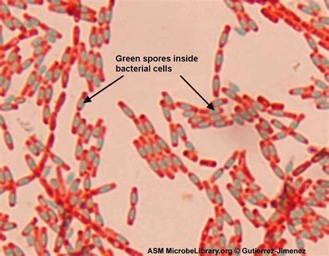 Bacillus Subtilis Gram Stain Bacillus Subtilis Bacillus Bacteria The Best Porn Website